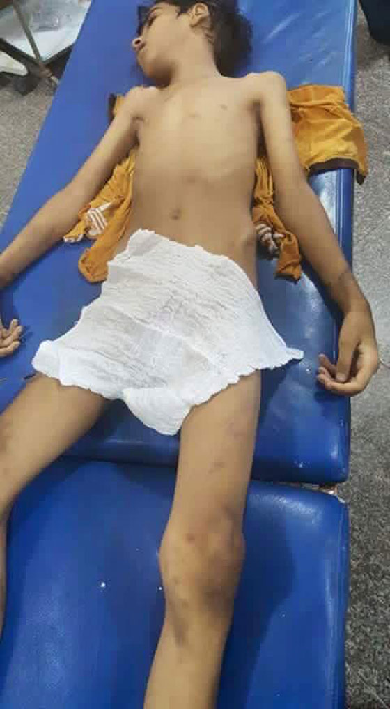 اب عراقي يعذب ابنه (11 عاما) حتى الموت ارضاء لزوجته الثانية صورة رقم 2