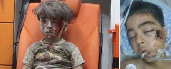 سوريا: موت شقيق عمران الحلبي بعد ايام من الضربة الجوية الصادمة صورة رقم 1