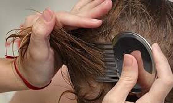  القملة بـ14 درهم وبلدية دبي تفرض غرامة على بيعها في الصالونات صورة رقم 3