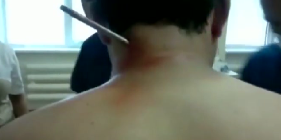 فيديو صادم.. سهم يخترق كتف صياد روسي ويخرج من عنقه صورة رقم 1 فيديو صادم.. سهم يخترق كتف صياد روسي ويخرج من عنقه صورة رقم 1