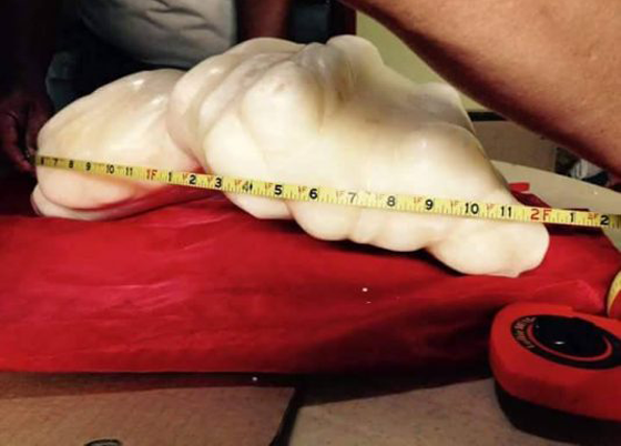 اكبر لؤلؤة في العالم تقع بين يدي صياد يجهل قيمتها!! صورة رقم 2 اكبر لؤلؤة في العالم تقع بين يدي صياد يجهل قيمتها!! صورة رقم 2