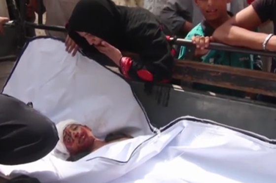 آلام وحسرة من موت إلى موت.. يوميات أطفال حلب صورة رقم 4 آلام وحسرة من موت إلى موت.. يوميات أطفال حلب صورة رقم 4