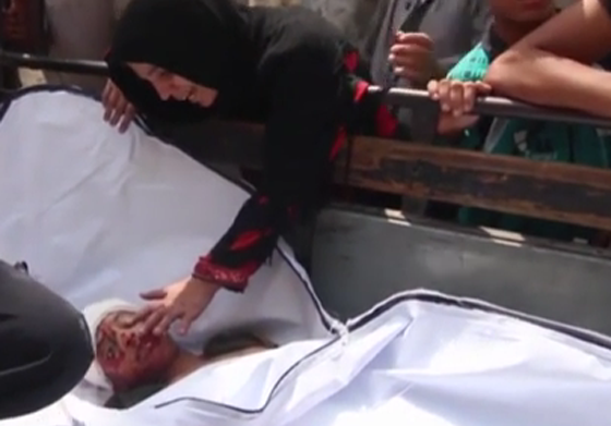 آلام وحسرة من موت إلى موت.. يوميات أطفال حلب صورة رقم 6 آلام وحسرة من موت إلى موت.. يوميات أطفال حلب صورة رقم 6