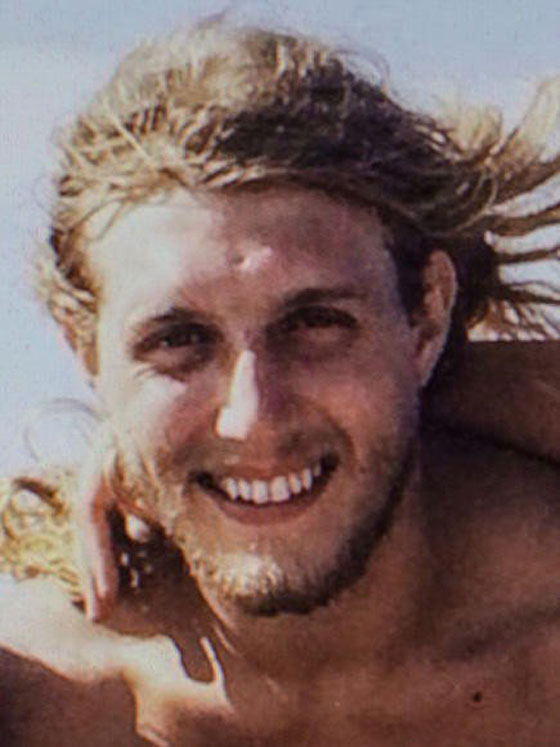 اول عملية زراعة وجه لرجل اطفاء امريكي تتكلل بالنجاح صورة رقم 5