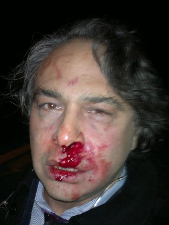 الاعتداء على مصمم ازياء شهير متهم باهانة الشعب التركي.. فيديو صورة رقم 1