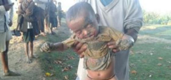 صور مؤلمة: ايلان كردي، محمد شهيت واطفال قتلوا دون رحمة  صورة رقم 6