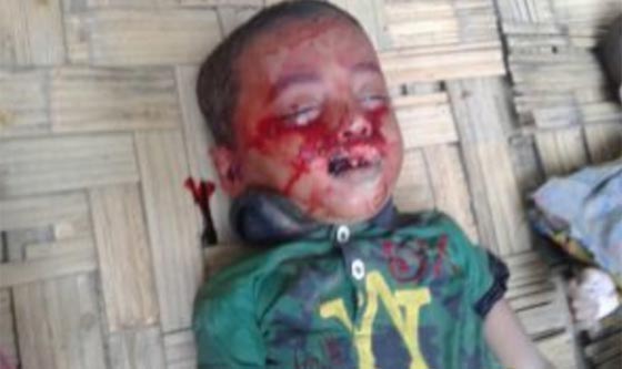 صور مؤلمة: ايلان كردي، محمد شهيت واطفال قتلوا دون رحمة  صورة رقم 9