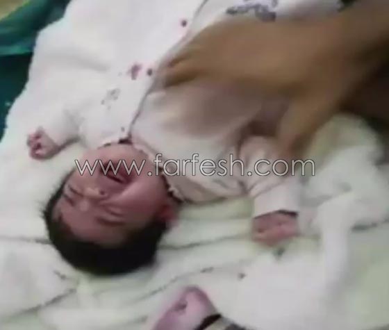 طفلة تتعرض للضرب بطريقة وحشية ووالدتها تكشف تفاصيل صادمة  صورة رقم 2