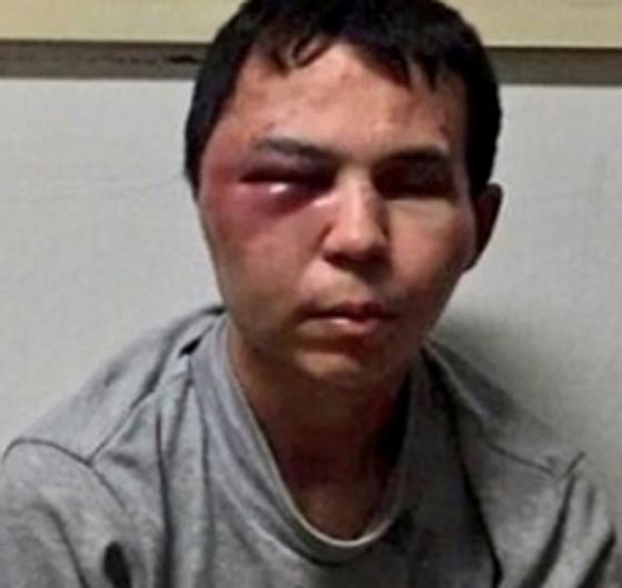 متورم العينين والوجه.. صور سفاح اسطنبول قبل وبعد القبض عليه  صورة رقم 5