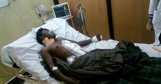 نجاة شاب من الموت باعجوبة بعد ان ضربه شقيقه 3 سهام في بطنه.. صور صورة رقم 1