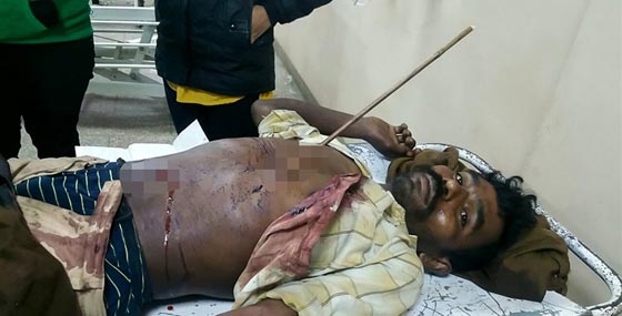 نجاة شاب من الموت باعجوبة بعد ان ضربه شقيقه 3 سهام في بطنه.. صور صورة رقم 3