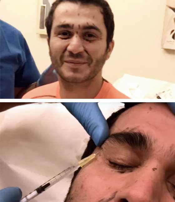 حتى المشاهير الرجال يقومون بعمليات تجميل وحقن البوتوكس لكنهم لا يعترفون!   صورة رقم 5