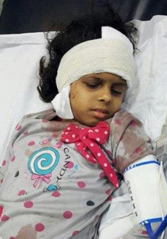 عاملة منزلية متوحشة تشوه وجه طفلتين وتعتدي على امهما صورة رقم 2