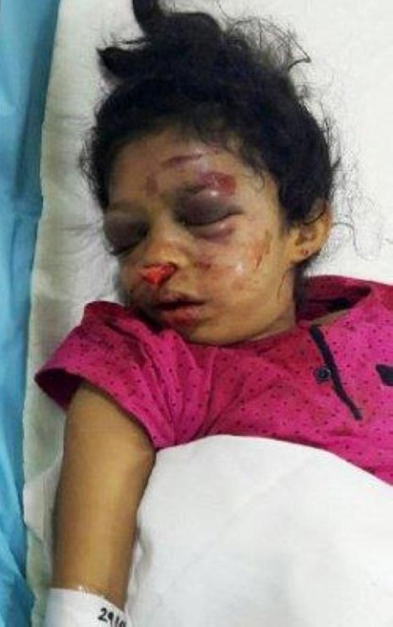 عاملة منزلية متوحشة تشوه وجه طفلتين وتعتدي على امهما صورة رقم 1