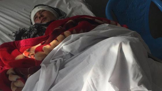 افغاني يقطع اذني زوجته وآخر يقطع لزوجته انفها صورة رقم 3