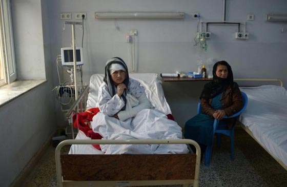 افغاني يقطع اذني زوجته وآخر يقطع لزوجته انفها صورة رقم 4