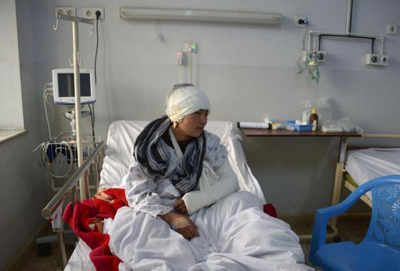 افغاني يقطع اذني زوجته وآخر يقطع لزوجته انفها صورة رقم 5