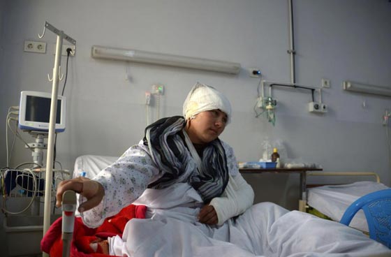 افغاني يقطع اذني زوجته وآخر يقطع لزوجته انفها صورة رقم 6