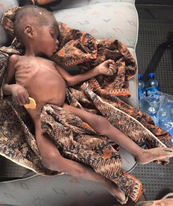 هل تذكرون الطفل النيجيري المشرد؟ قصة انسانية منحته حياة جديدة صورة رقم 8