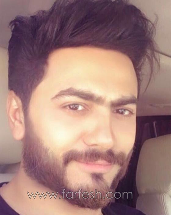فيديو وصور تامر حسني قبل وبعد (باروكة) شعر مستعار: الفارق هائل! صورة رقم 10