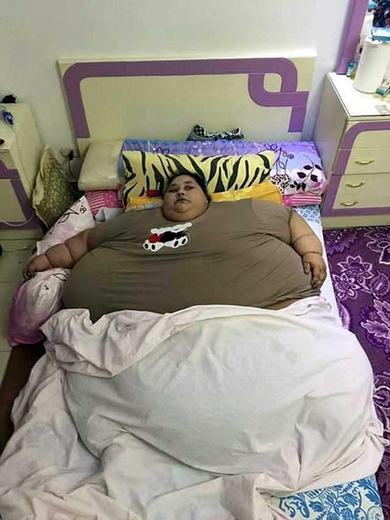 صور مذهلة.. مشروع نقل فتاة مصرية تزن نصف طن الى الهند بطائرة شحن صورة رقم 17