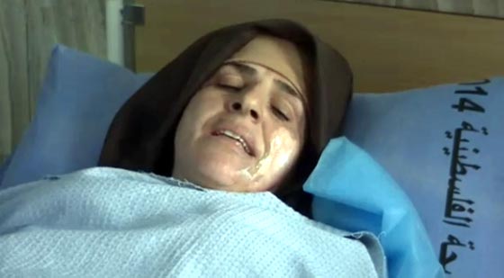 امراة فلسطينية تشعل النار بجسدها بسبب ملاحقة الشرطة لزوجها  صورة رقم 2