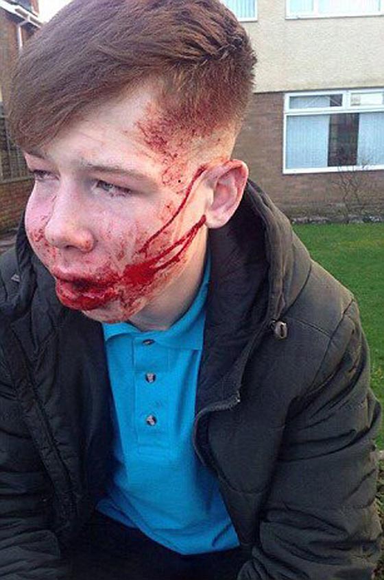 صور صادمة.. تعرض صبي للضرب والتخويف اثناء عودته من المدرسة صورة رقم 2