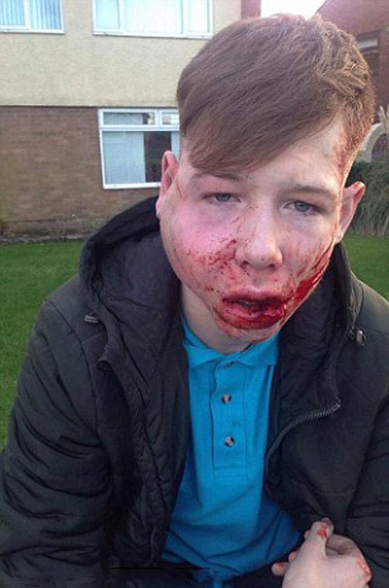 صور صادمة.. تعرض صبي للضرب والتخويف اثناء عودته من المدرسة صورة رقم 1