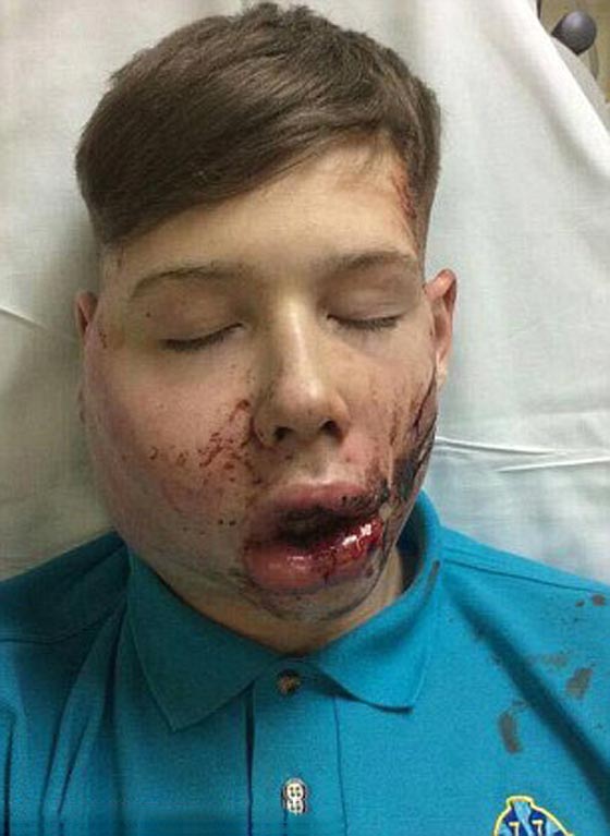 صور صادمة.. تعرض صبي للضرب والتخويف اثناء عودته من المدرسة صورة رقم 3