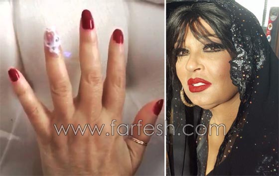  صور فنانين سخر منهم الجمهور لأنهم هوّلوا امراضهم البسيطة! صورة رقم 1