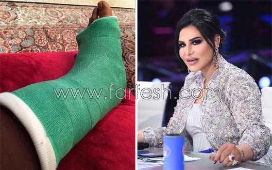  صور فنانين سخر منهم الجمهور لأنهم هوّلوا امراضهم البسيطة! صورة رقم 4