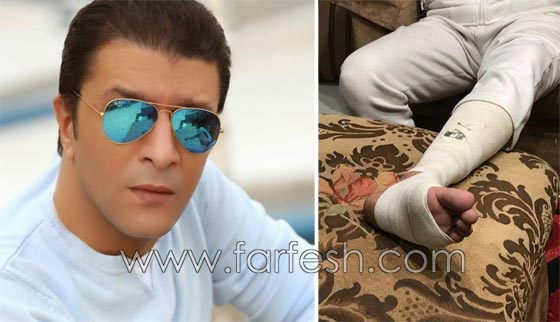  صور فنانين سخر منهم الجمهور لأنهم هوّلوا امراضهم البسيطة! صورة رقم 6
