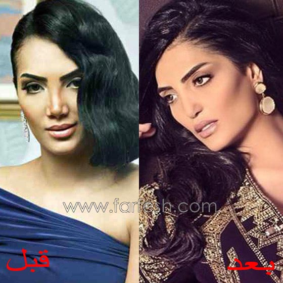  صور فنانين سخر منهم الجمهور لأنهم هوّلوا امراضهم البسيطة! صورة رقم 7