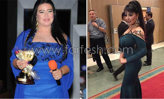  صور فنانين سخر منهم الجمهور لأنهم هوّلوا امراضهم البسيطة! صورة رقم 8