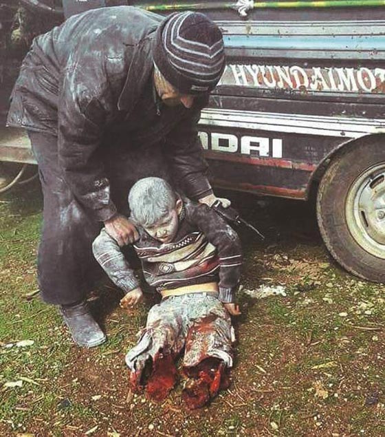 فيديو مروع.. طفل سوري مبتور الساقين ينادي باكيا (بابا شيلني) صورة رقم 4