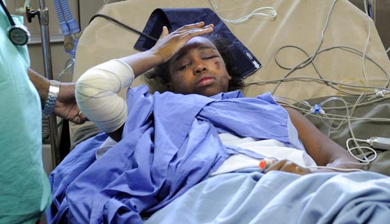  تجارب مرعبة لأشخاص نجوا من الموت: احدهم نهش دب رأسه وأخرى دُفنت حيّة صورة رقم 3