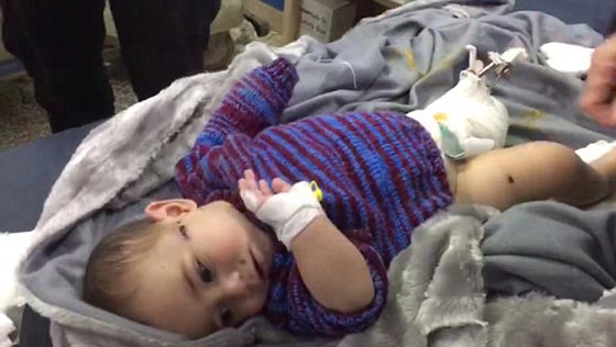 فيديو مؤثر.. طبيب بريطاني يلتقي طفلة سورية لم تفارق خياله منذ عالجها صورة رقم 2