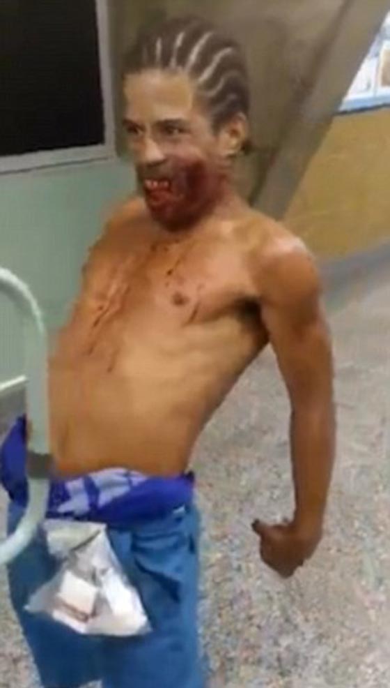 فيديو مرعب: مس شيطاني اصاب شاب برازيلي انطلقت رصاصة في وجهه صورة رقم 2