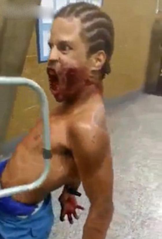 فيديو مرعب: مس شيطاني اصاب شاب برازيلي انطلقت رصاصة في وجهه صورة رقم 3