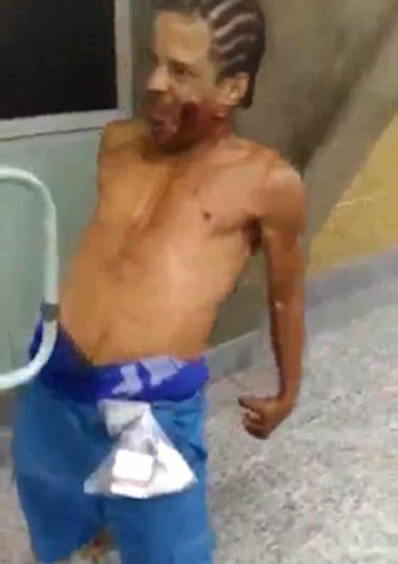 فيديو مرعب: مس شيطاني اصاب شاب برازيلي انطلقت رصاصة في وجهه صورة رقم 4