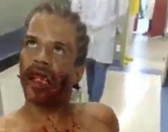 فيديو مرعب: مس شيطاني اصاب شاب برازيلي انطلقت رصاصة في وجهه صورة رقم 5