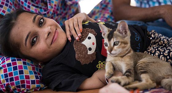  صور غريبة: مراهقة هندية كُسرت عظامها 1000 مرة بسبب مرض نادر  صورة رقم 4