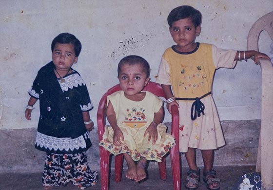  صور غريبة: مراهقة هندية كُسرت عظامها 1000 مرة بسبب مرض نادر  صورة رقم 12