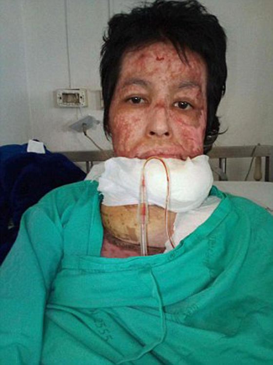 زوج غيور أحرق زوجته حية، بسبب صور سيلفي! تحذير: مشاهد مؤلمة صورة رقم 2