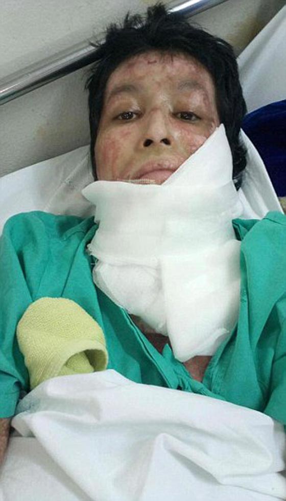 زوج غيور أحرق زوجته حية، بسبب صور سيلفي! تحذير: مشاهد مؤلمة صورة رقم 7