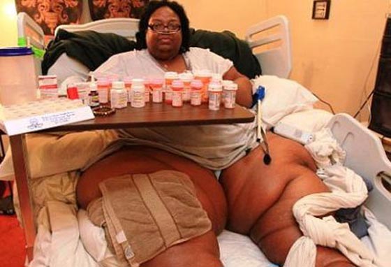 هؤلاء هم اسمن 10 اشخاص في العالم اولهم ايمان المصرية.. فيديو صورة رقم 2