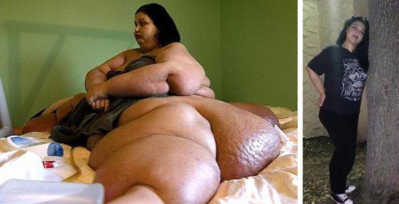 هؤلاء هم اسمن 10 اشخاص في العالم اولهم ايمان المصرية.. فيديو صورة رقم 4