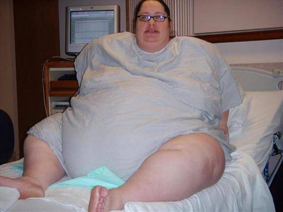 هؤلاء هم اسمن 10 اشخاص في العالم اولهم ايمان المصرية.. فيديو صورة رقم 9