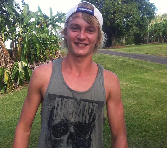  مراهق يحاول إبهار صديقته في رهان فيتعرض لـ (عضة تمساح)! صورة رقم 3