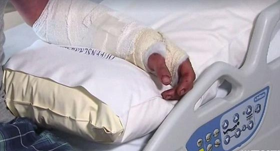  مراهق يحاول إبهار صديقته في رهان فيتعرض لـ (عضة تمساح)! صورة رقم 6